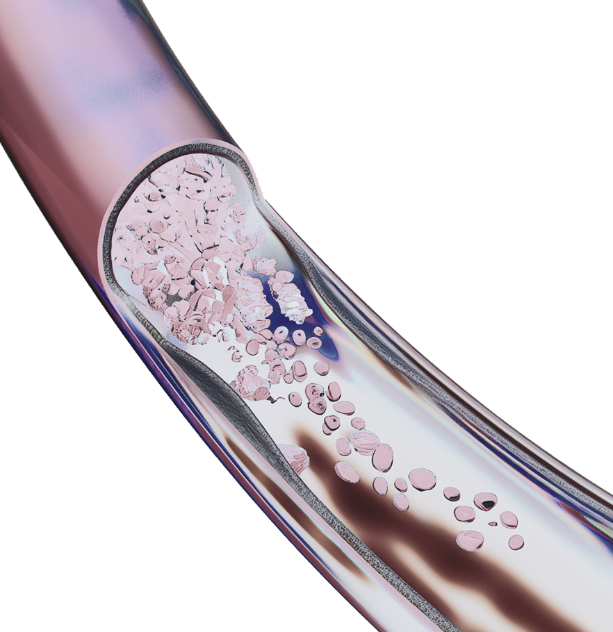 Лікування судинних патологій