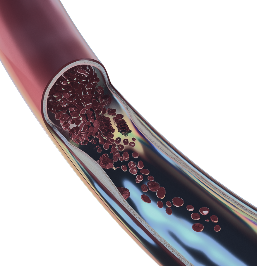 Лікування судинних патологій