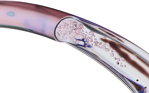 Судинна нейрохірургія